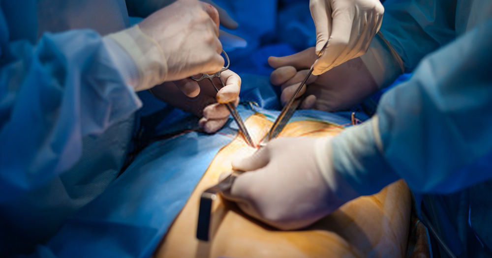 Laparoscopic Surgery – The Adjustable Gastric Band